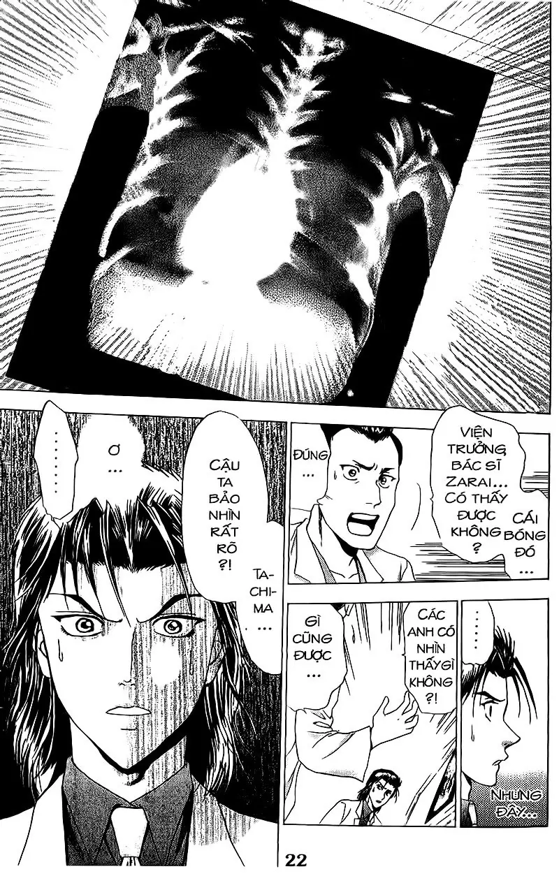 Bàn Tay Thần Sầu Teru Chapter 57 - Trang 18