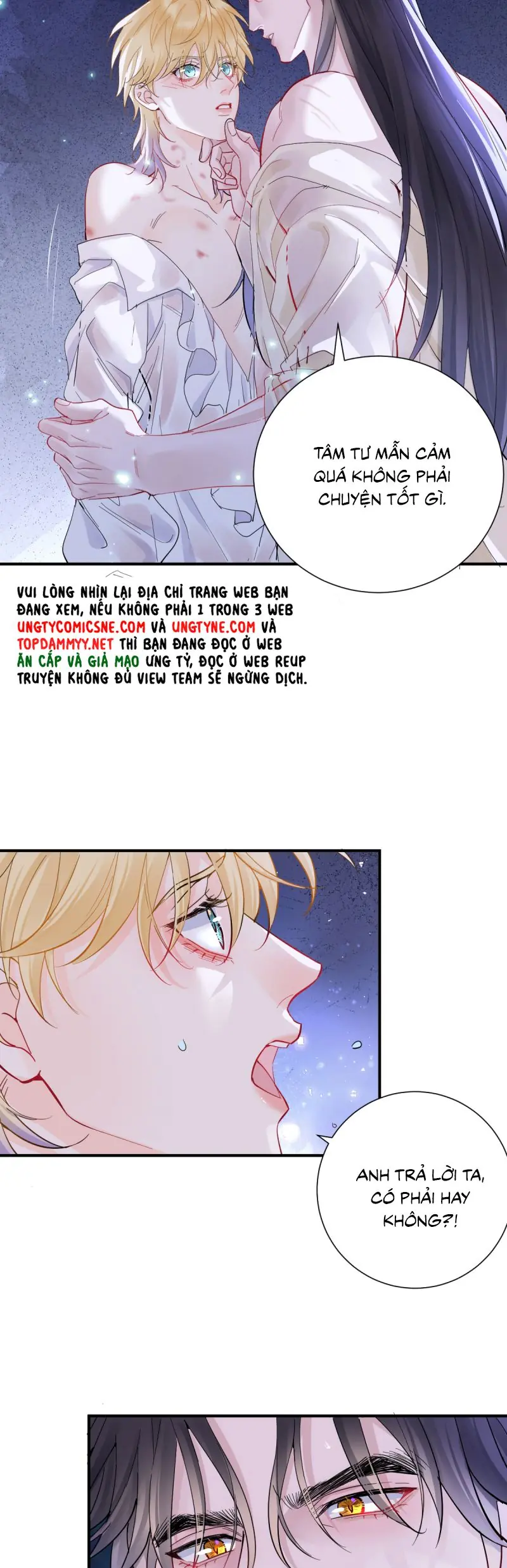 Bản Tình Ca Nụ Hôn Tù Ái Chapter 35 - Trang 31