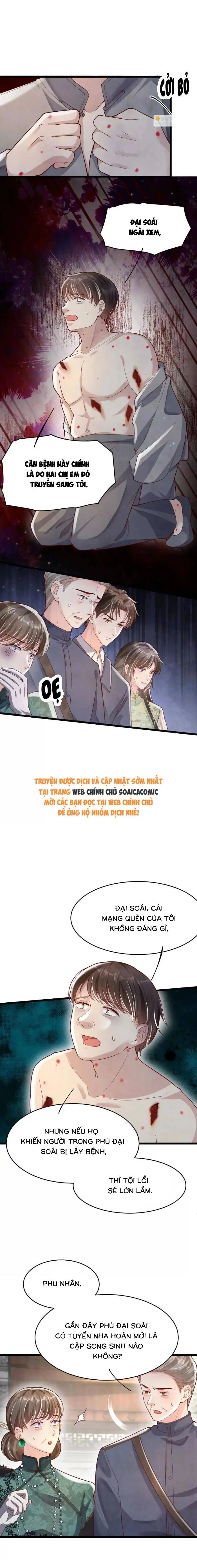 Phần 2-Tôi Có Ông Chồng Hay Ghen Chapter 170 - Trang 4