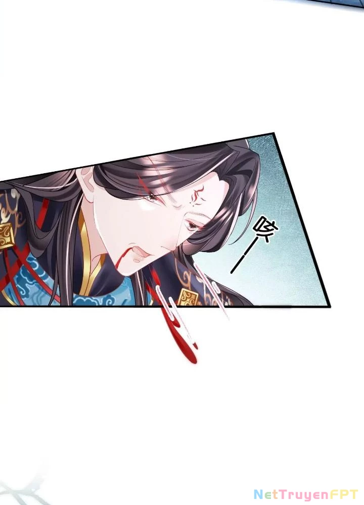 Thiên Hạ Vô Song Chapter 75 - Trang 46